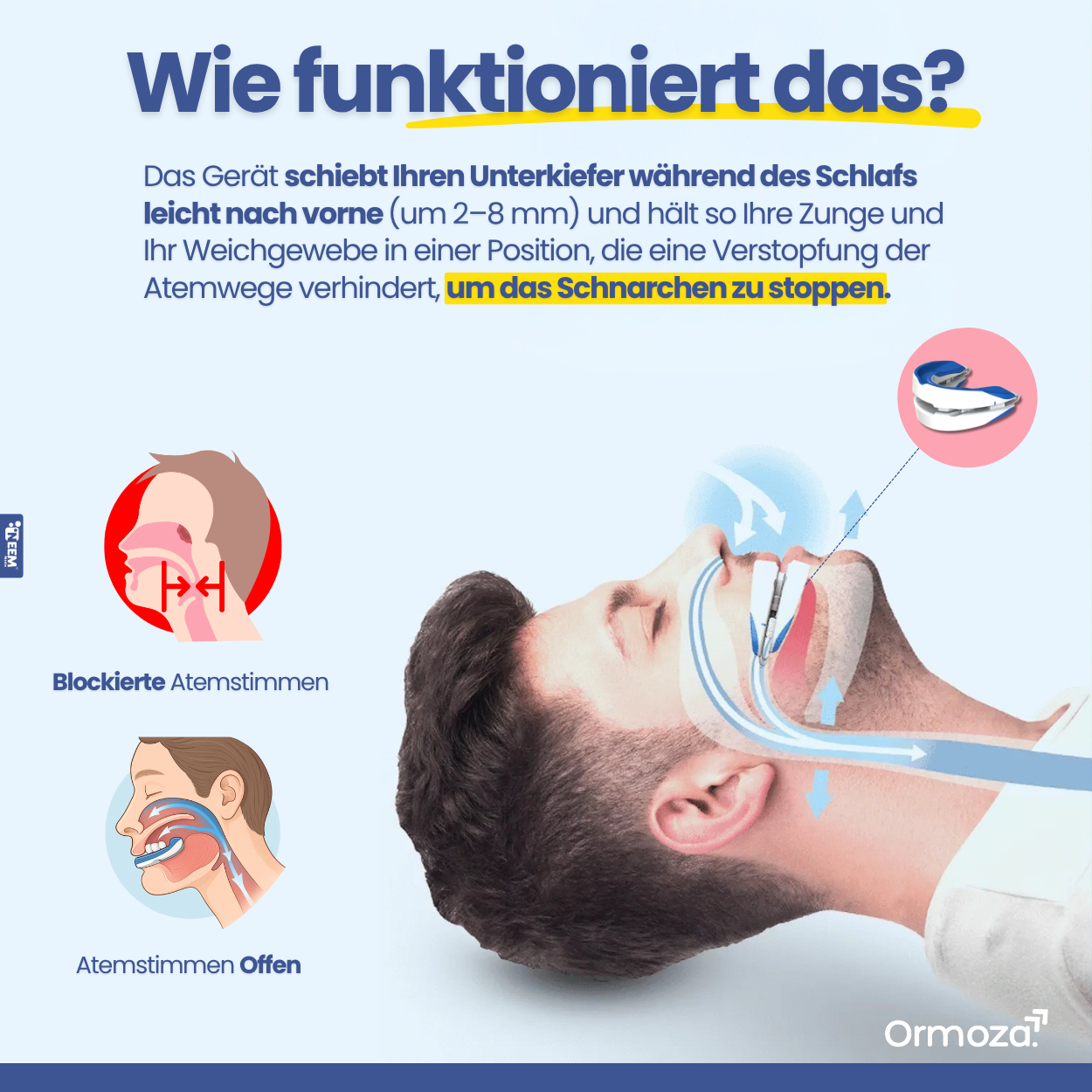 Anti-Schnarch-Mundstüc